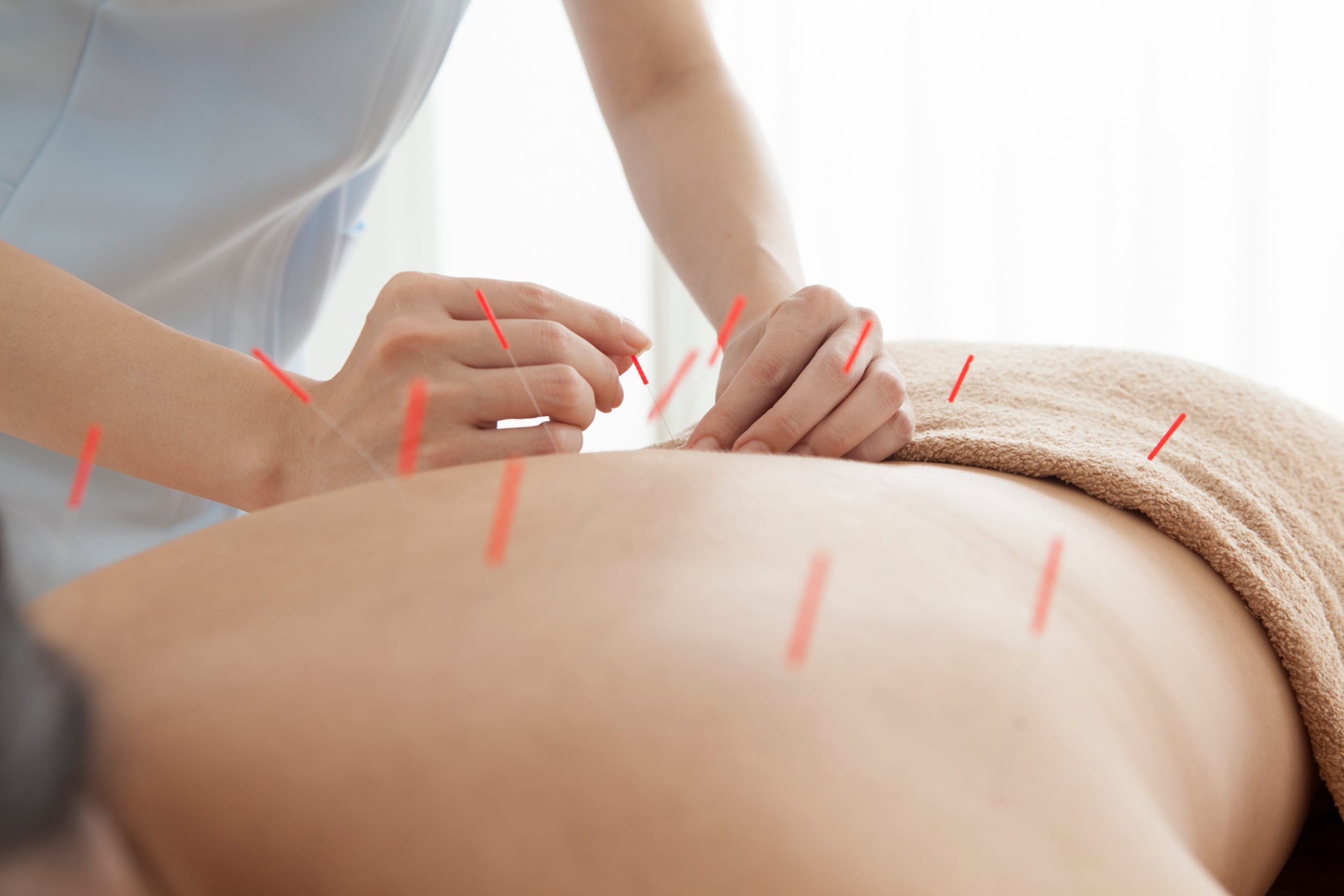 Canadian Institute of Traditional Chinese Medicine (CITCM) - Orthopedic Sports Acupuncture