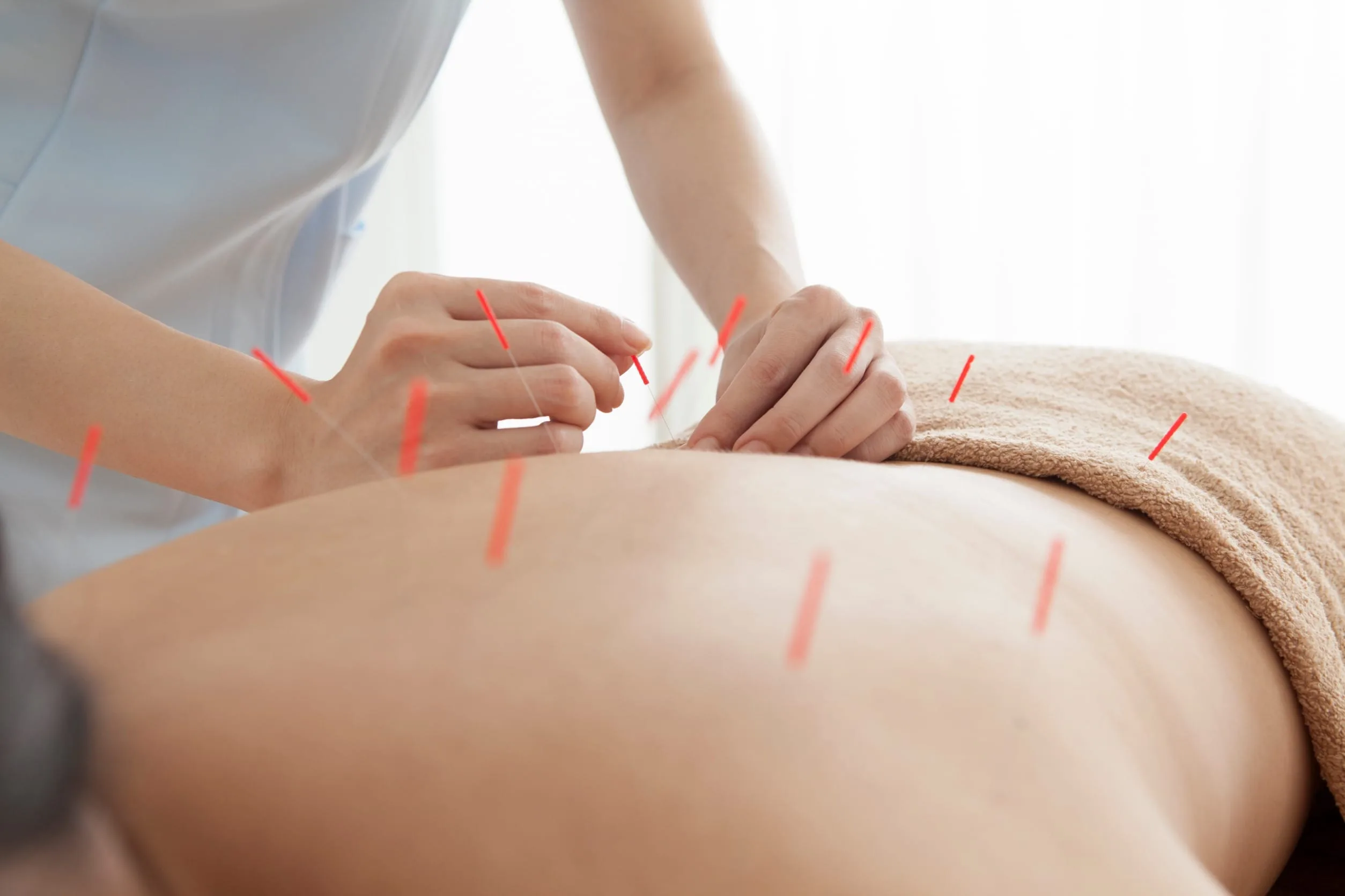 Canadian Institute of Traditional Chinese Medicine (CITCM) - Orthopedic Sports Acupuncture