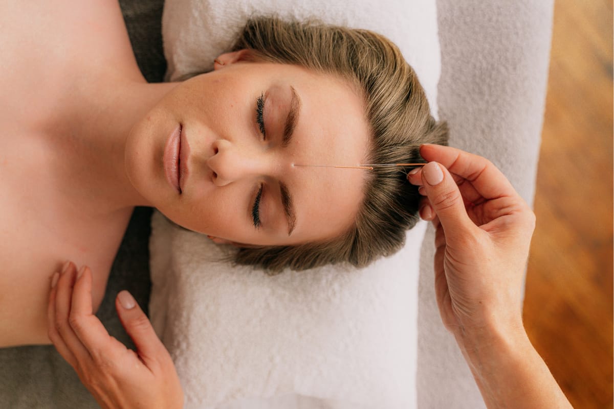 Acupuncture facial needling treatment–a technique taught at massage therapy and acupuncture schools CITCM